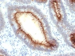 CEACAM5/CD66e Antibody (SPM330), Novus Biologicals 0.2mg; Unlabeled:Antibodies,